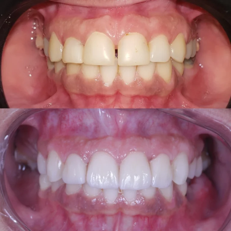 Stories de nova coleção fotos moda neutro